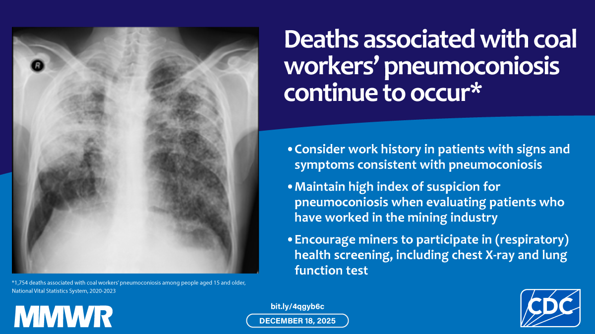 Coal Workers’ Pneumoconiosis–Associated Deaths — United States, 2020–2023
