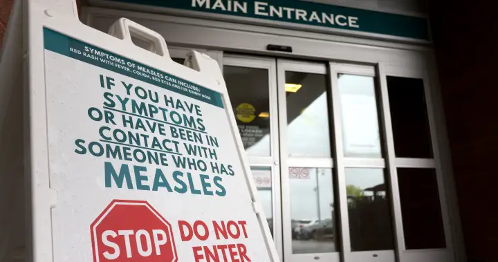 Measles alert urges countries to vaccinate more, including Canada – National